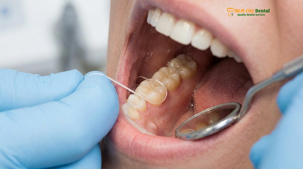 Clinical photography related to oral hygiene steps