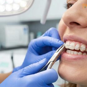 Comprehensive Orthodontic Care Guide | HCMC Dental