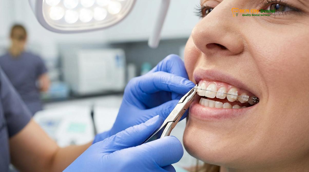 Clinical illustration of orthodontic care guide