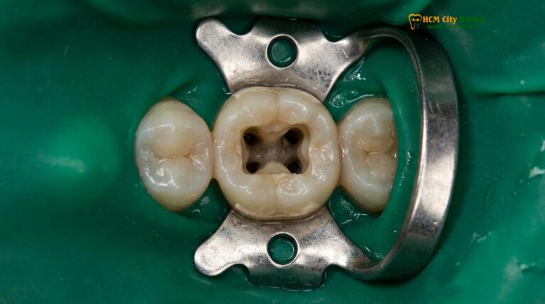 Pain After Root Canal: Normal vs Emergency | HCMC Dental