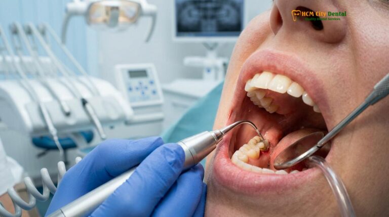 Scaling and Root Planing Cost in Vietnam: Clinical Guide & Pricing
