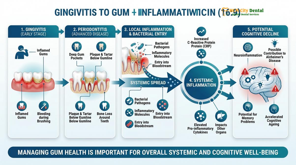 Summary diagram of periodontitis alzheimer