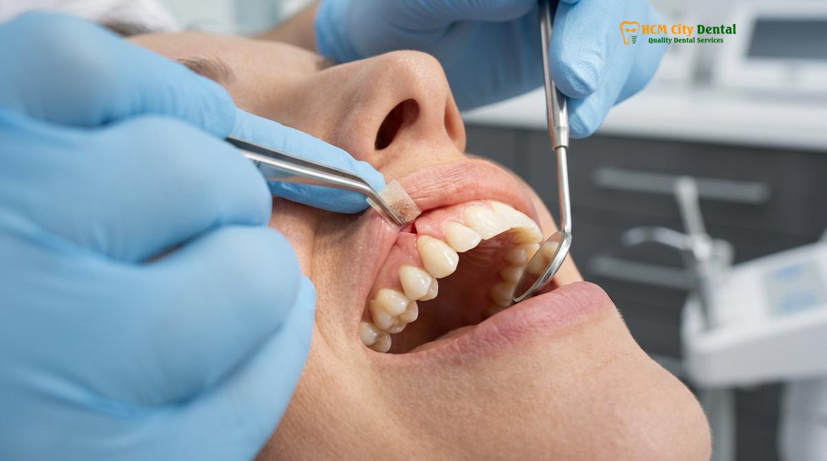 Visual description of pinhole surgical technique