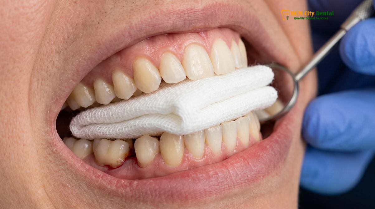 Clinical photography related to bleeding after tooth extraction