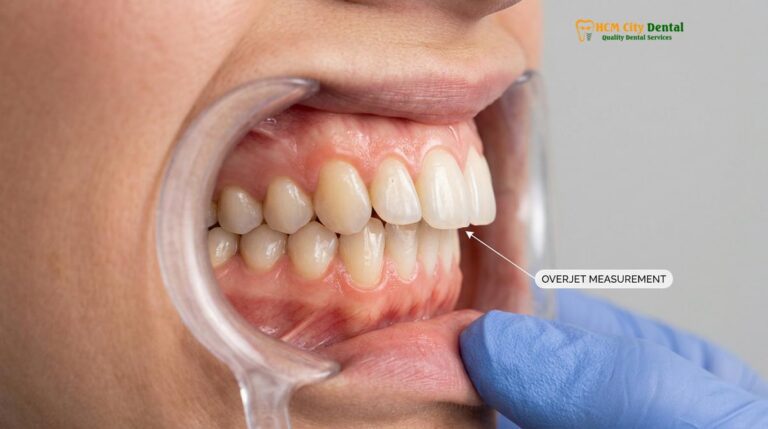 Removable Braces for Teeth: Clinical Guide & Types | HCMC Dental