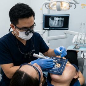 Root Canal Cost Vietnam vs Singapore Guide | HCMC Dental