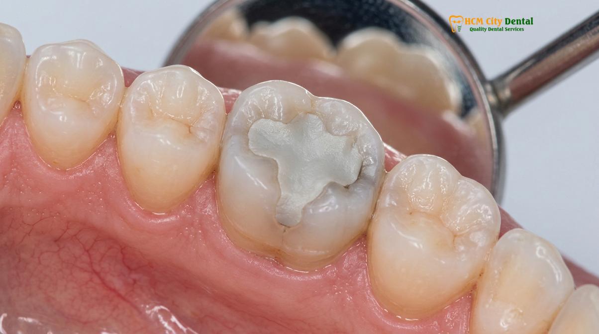 Visual description of Root Canal Recovery Guide
