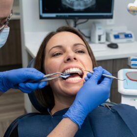 Stabilisation Splint TMD Cost & Clinical Guide | HCMC Dental