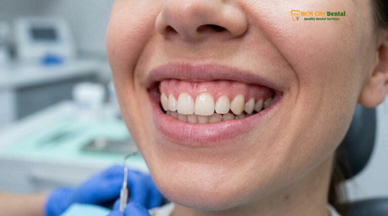 Lip Repositioning Surgery Saigon: Clinical Guide to Gummy Smile Correction