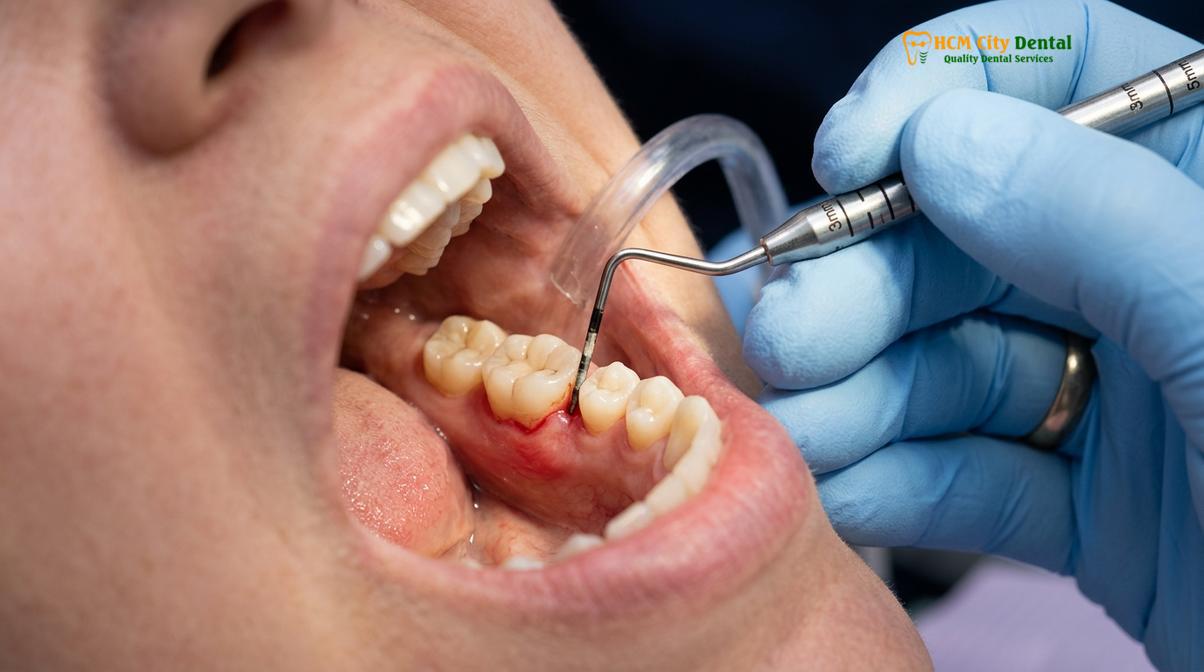 Clinical photography related to swollen gums around tooth