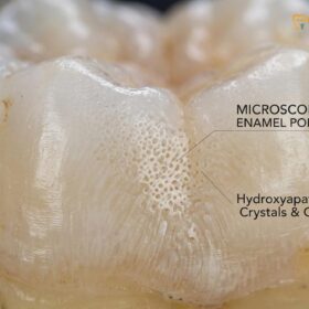Whitening for Smokers & Coffee Stains: Clinical Dental Guide