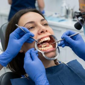 Temporary Dental Crown Care While Traveling: Clinical Guide