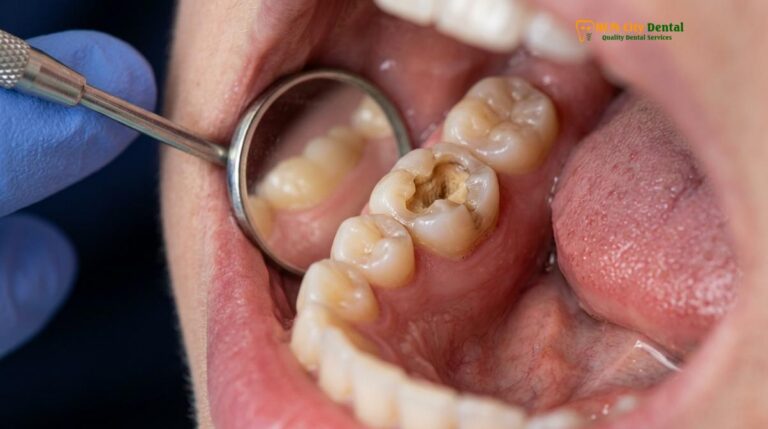 Temporary Tooth Repair DIY: Safe Clinical Guide | HCMC Dental
