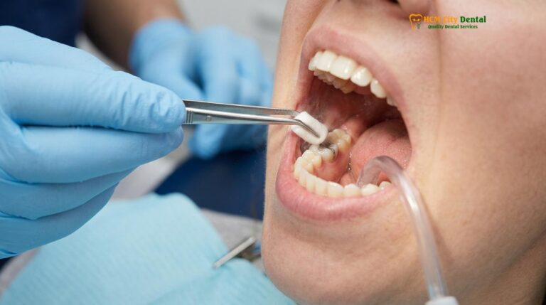Tooth Pulp Vitality Test: Clinical Guide & Results | HCMC Dental