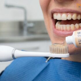 Best Toothpaste for Veneers: A Clinical Guide to Protecting Your Smile