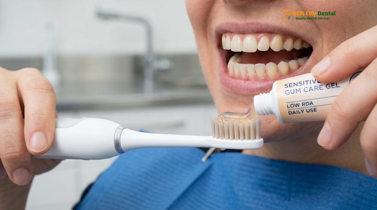 Clinical illustration of best toothpaste for veneers