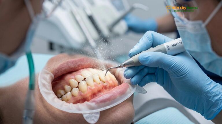 Ultrasonic Scaling vs Hand Scaling: Clinical Guide | HCMC Dental