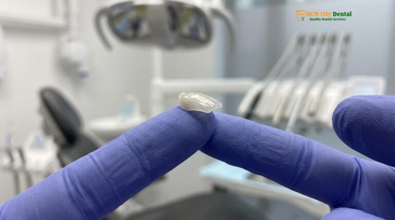 Ultra Thin Veneers: Clinical Guide to No-Prep Smile Design
