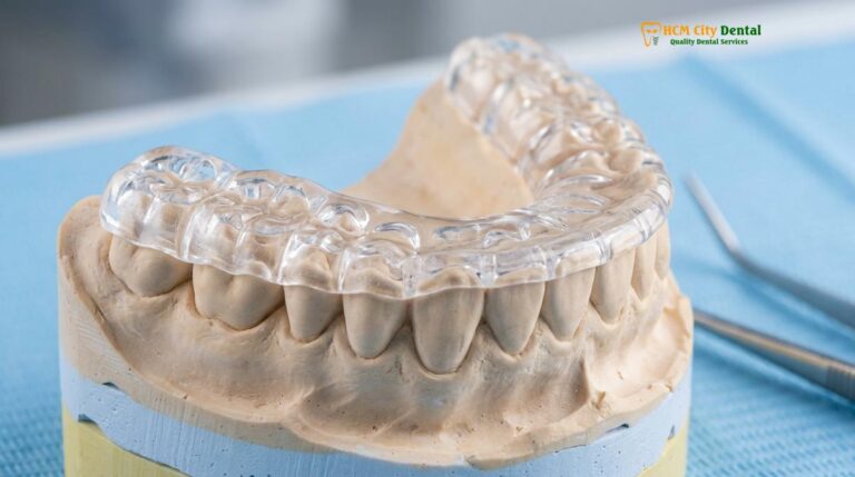 Upper or Lower Night Guard: Clinical Guide | HCMC Dental