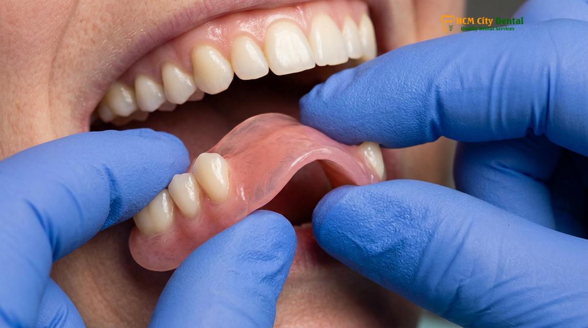 Visual description of Valplast Dentures Vietnam