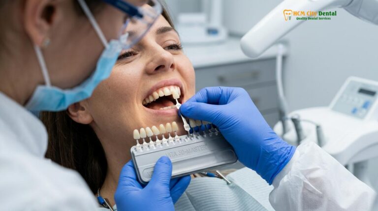 Veneer Shade Guide: Clinical Selection & Color Matching