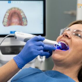 Veneers vs Crowns vs Bonding: Clinical Guide & Cost Comparison