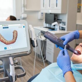 Porcelain Veneers Warranty in Vietnam: Clinical Coverage & Guide
