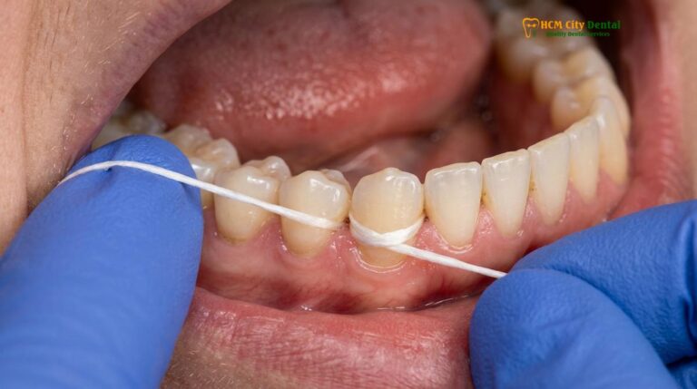 Water Flosser vs String Floss & Scaling: A Clinical Comparison