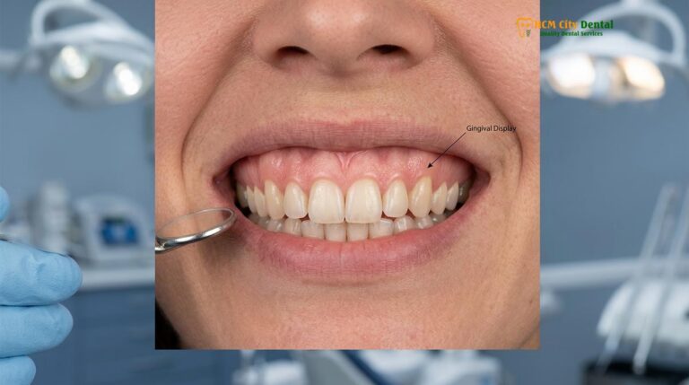 What Causes a Gummy Smile? The 5 Main Clinical Reasons