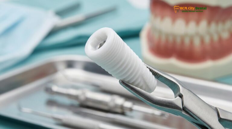 Zirconia Dental Implants: Clinical Guide | HCMC Dental