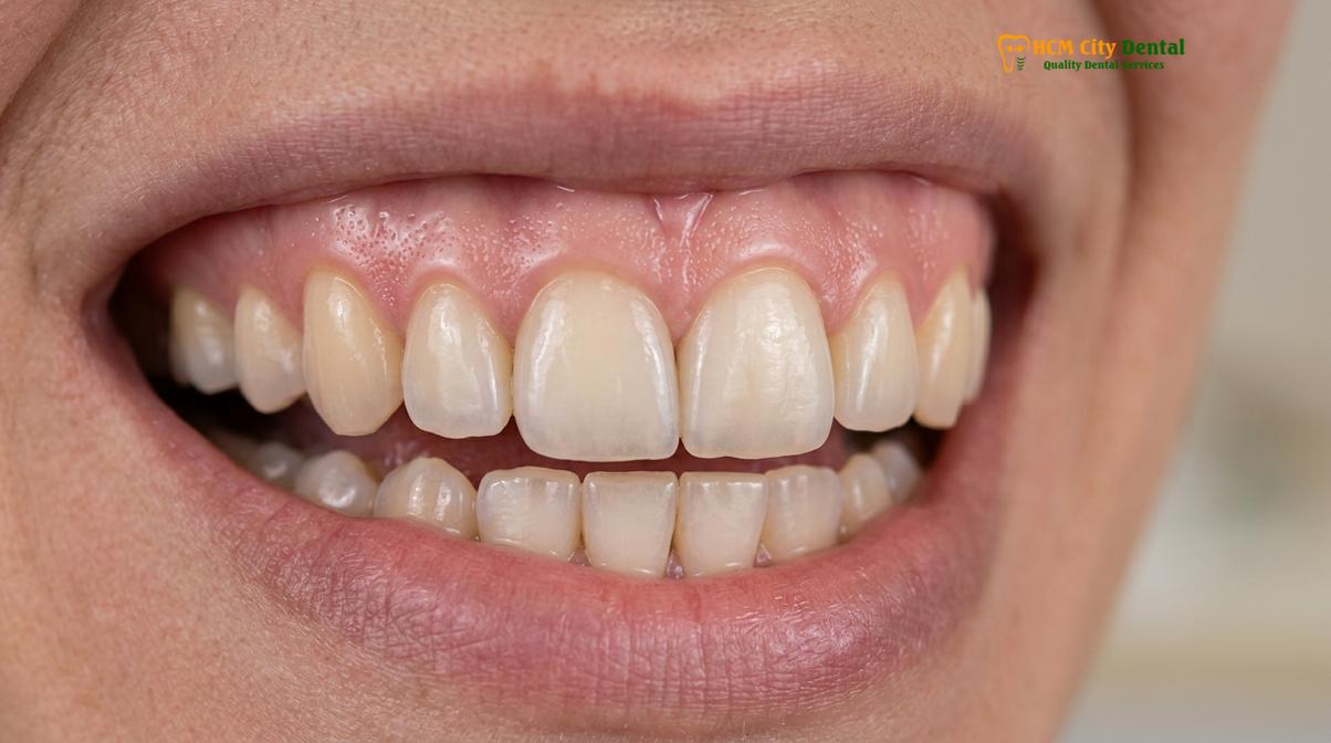 Visual description of zirconia dental implants