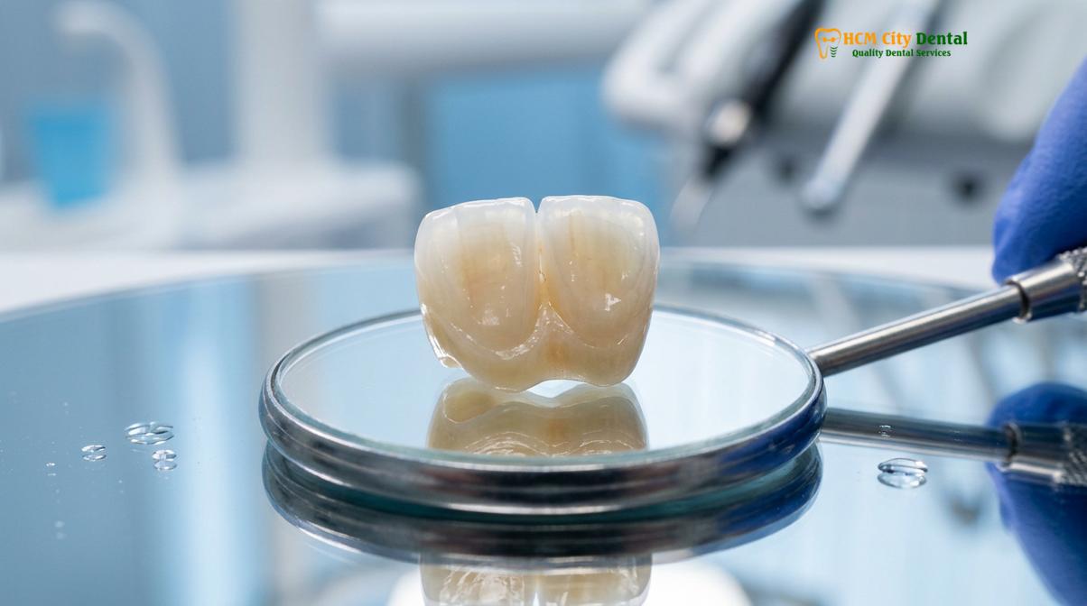 Visual illustration of zirconia crown vs porcelain crown