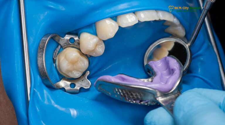 Zirconia Crowns Vietnam: Clinical Guide & Costs | HCMC Dental