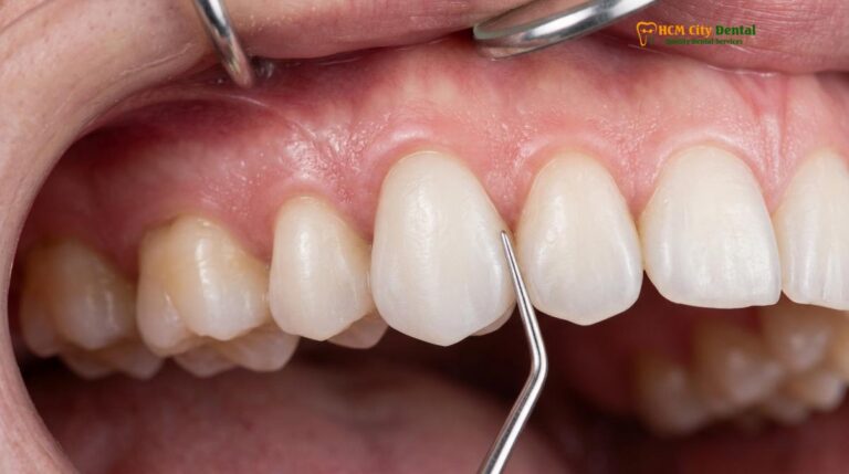 Zirconia Implant Cost Vietnam: Premium Metal-Free Guide | HCMC Dental