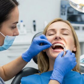 Can I Whiten My Teeth With Braces? | HCMC Dental