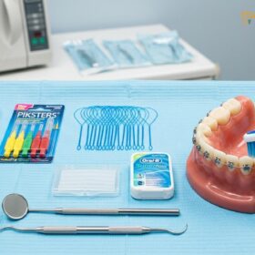 Best Dental Kit for Braces: Clinical Guide | HCMC Dental