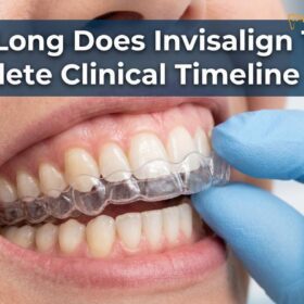 How Long Does Invisalign Take? Clinical Timeline & Workflows