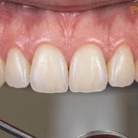 White Dental Beauty Teeth Whitening Guide | HCMC Dental
