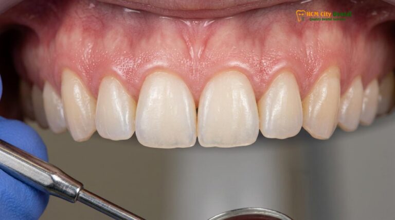 White Dental Beauty Teeth Whitening Guide | HCMC Dental