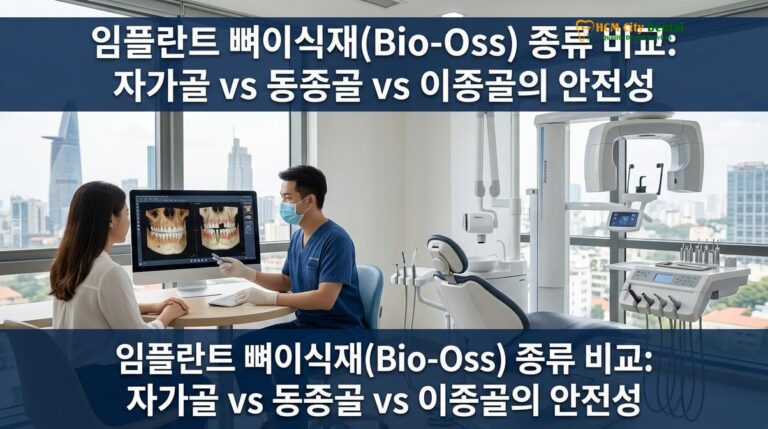 임플란트 뼈이식재(Bio-Oss) 종류 비교: 자가골 vs 동종골 vs 이종골의 안전성 — 닥터 끄엉 원장 | HCMC Dental