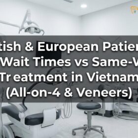 Dental Implant Cost Vietnam vs UK: NHS Alternatives & Prices