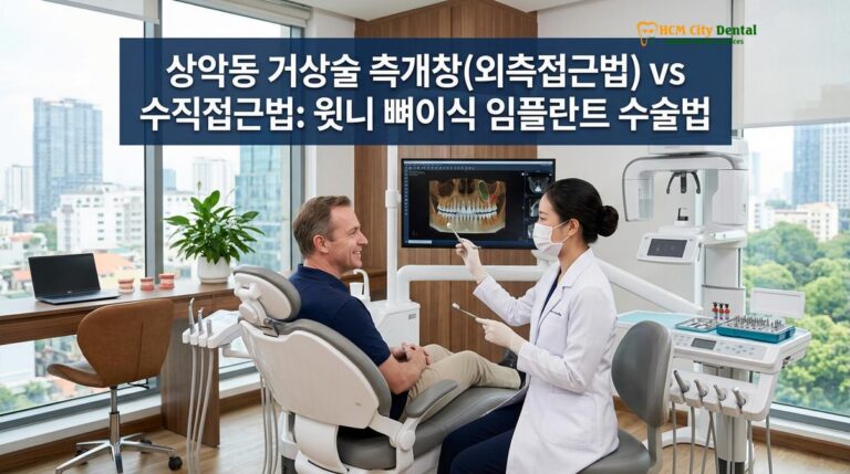상악동 거상술 측개창(외측접근법) vs 수직접근법: 윗니 뼈이식 임플란트 수술법 — 닥터 끄엉 원장 | HCMC Dental