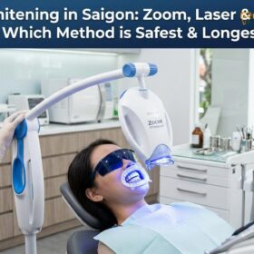 Best Laser Teeth Whitening Clinic Saigon | Philips Zoom & At-Home